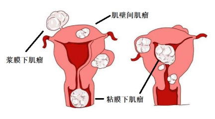 微信截图_20200407111326.png