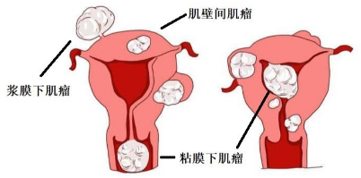 微信截图_20200525101507.png