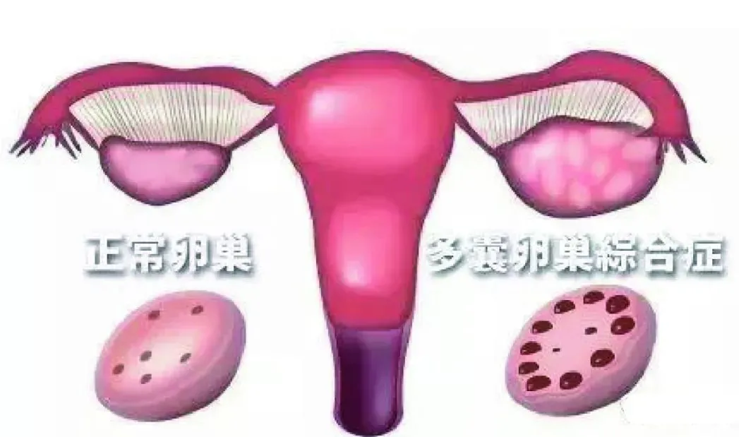 a027a3745008061e8ebeb19ed3bc2d5.png