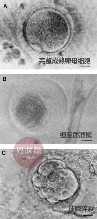 完整成熟卵母细胞 细胞质凝聚 细胞碎裂.png