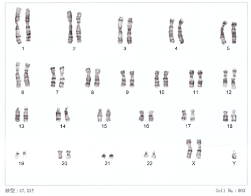 克氏综合征-Human_chromosomesXXY01_1