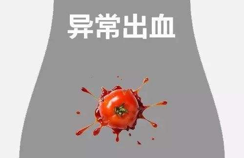 异常出血.jpg