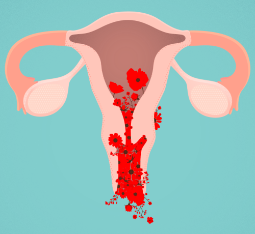 Abnormal Bleeding