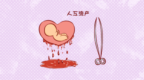 人工流产 漫画001