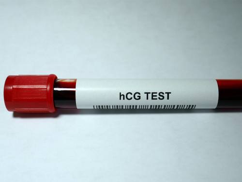 how hCG levels affect pregnancy