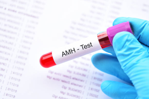 AMH test 001.png