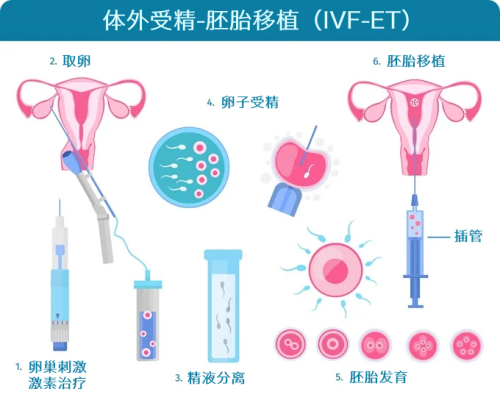 体外受精-胚胎移植（IVF-ET）001.png