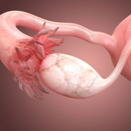 卵巢 输卵管 3D port-ecografia-pelvica-a.png