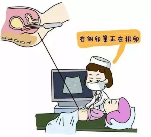 B超 检测排卵 漫画002.png