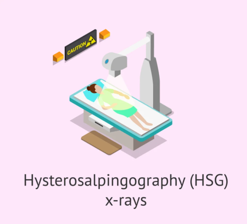 HSG types-salpingography-2048x870.png_1.png