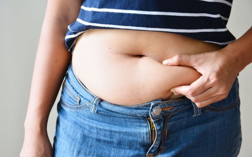 how to get rid of PCOS belly fat 多囊卵巢综合征肥胖型如何减重
