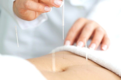 女性 针灸 促孕 Fertility Acupuncture.png