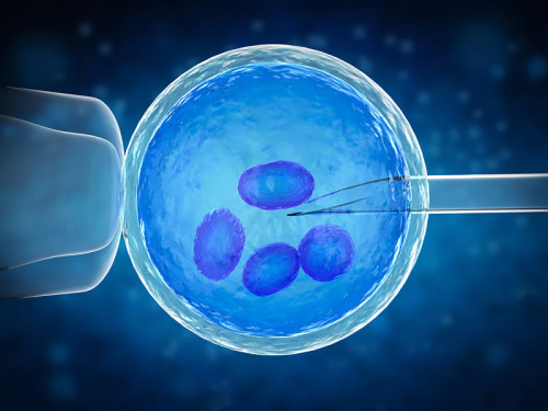 试管婴儿 artificial insemination ivf in vitro